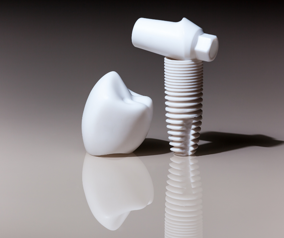 Plastic sculptures of dental implants